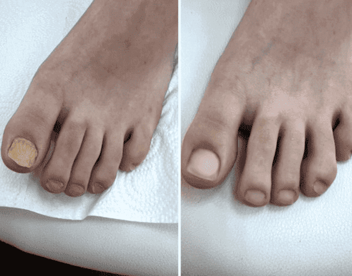 comment photo review