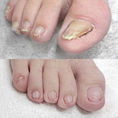 comment photo review